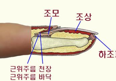 [건강정보] 손발톱 밑 검게 물들면 피부암 의심